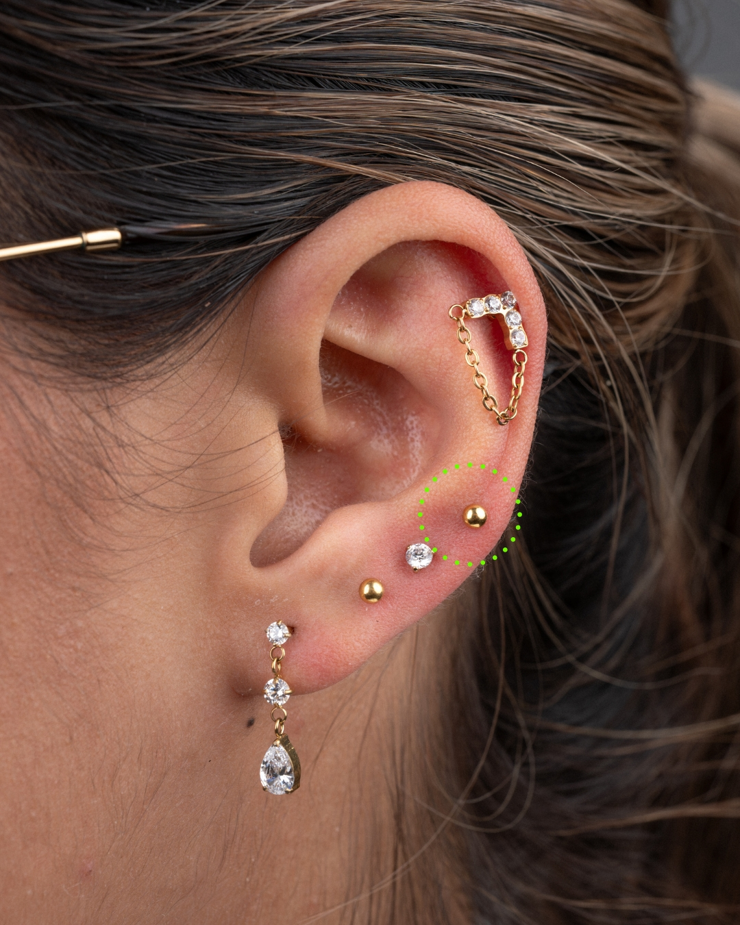 Upper lobe