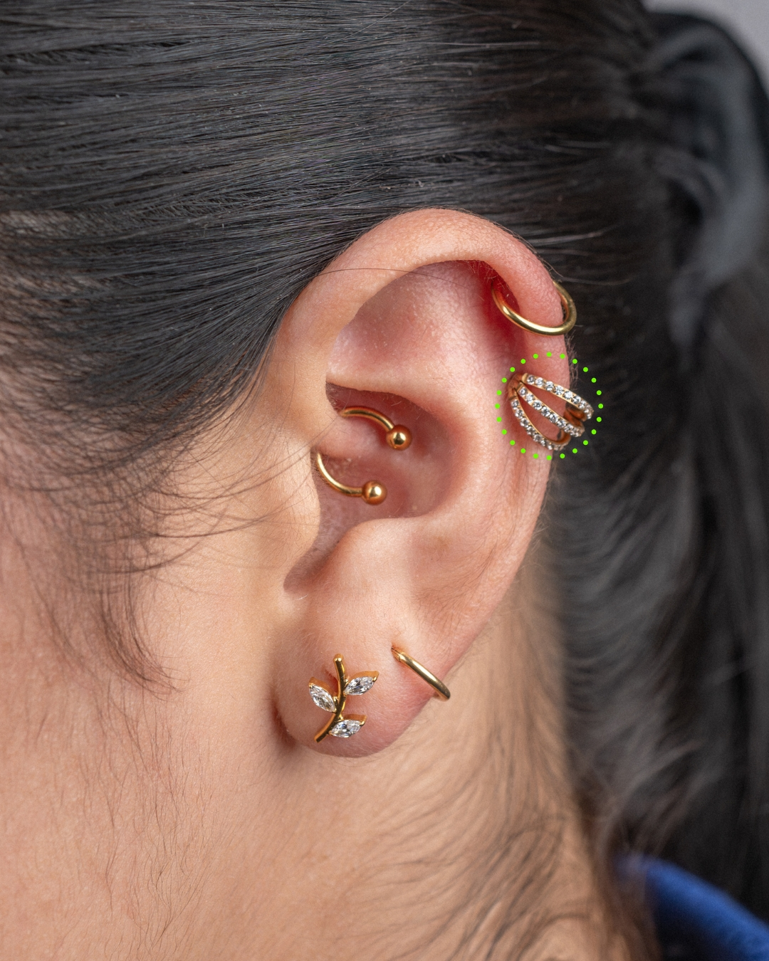 Upper lobe