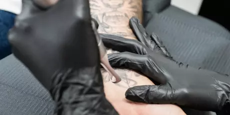 Our laser tattoo removal services