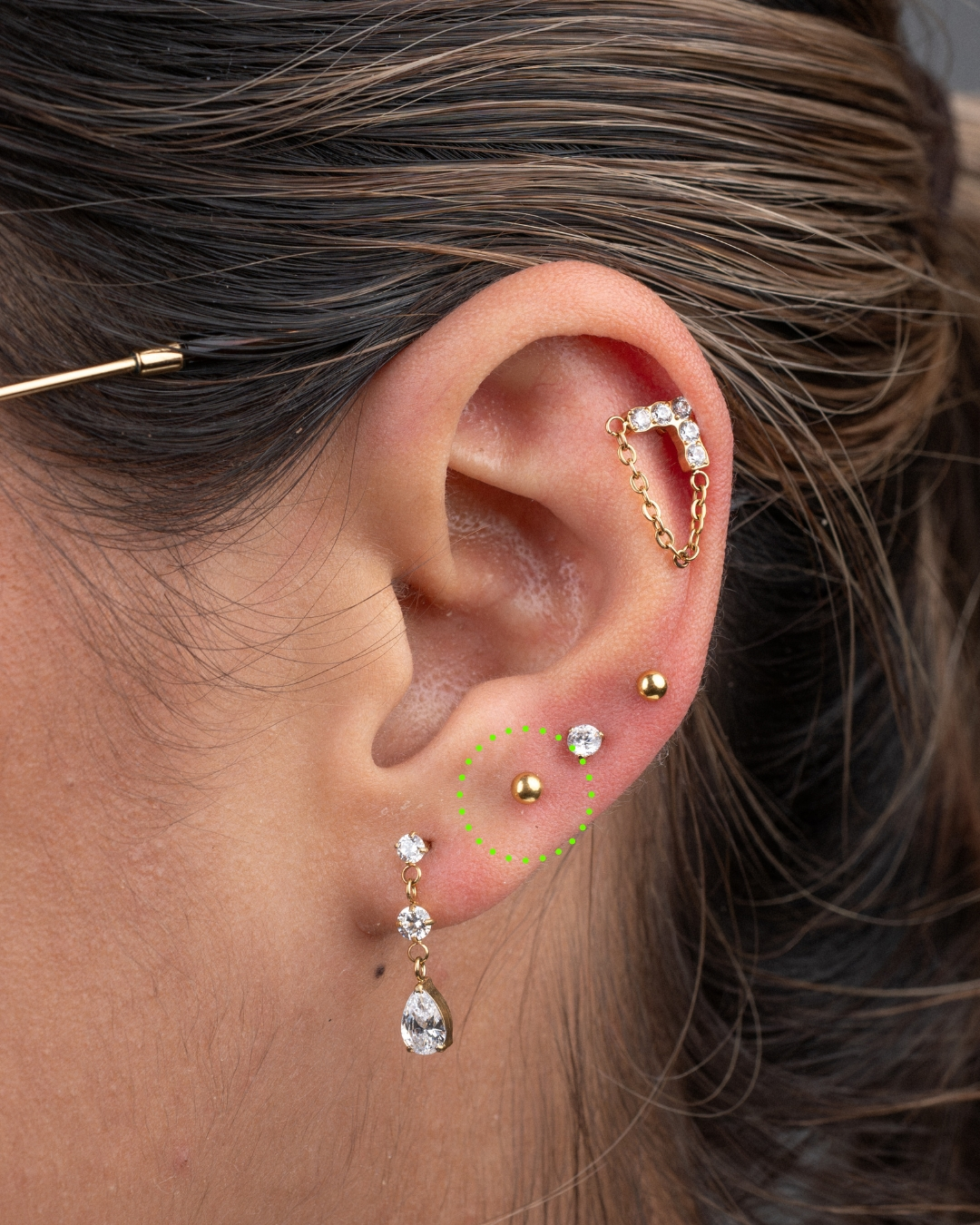 Upper lobe
