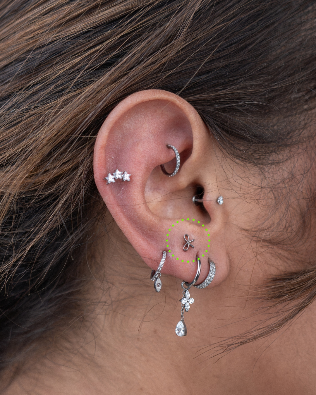 Anti-tragus
