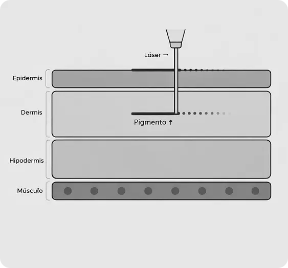 How picosecond laser works
